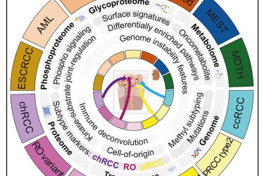 Diagnostics, Treatment Options Improve for Non-Clear Cell Renal Cell Carcinoma