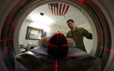 Traumatic Brain Injury Linked to Much Higher Risk of Arrhythmia in Veterans